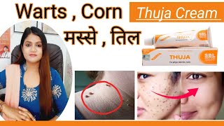 Thuja ointment for moles removal  thuja cream ke fayde  warts on face [upl. by Ahtebat]