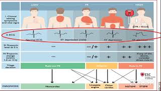 NSTEACS ESC 2020 guideline by Dr Abdalazeem Ibrahem [upl. by Zipah]