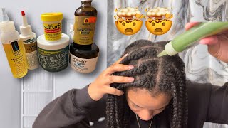 DIY GREASE FOR EXTREME HAIR GROWTH [upl. by Joashus423]