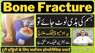 Bone Fracture ہڈی ٹوٹنا हड्डी का फ्रैक्चर Homeopathic Treatment by Dr Waqar Bhutta In Urdu  Hindi [upl. by Rimidalg]