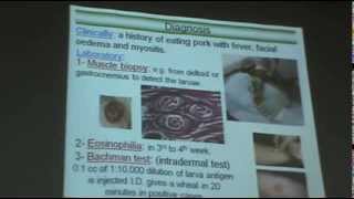 DrAzza Parasitology  Nematodes 6  Tissue Nematodes [upl. by Okiruy651]