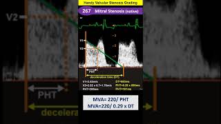 Handy Valvular Stenosis Values [upl. by Sihtnyc]