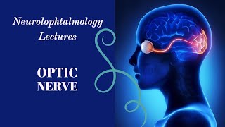 NEUROOPHTALMOLOGY lecture 2 OPTIC DISC EDEMA [upl. by Norvall827]