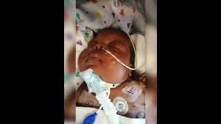 Part 7 Davina now got Tracheostomy New breathing passage trachea miraclebabies [upl. by Nugent]