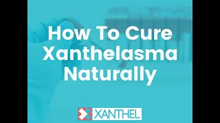 How To Cure Xanthelasma Naturally  Brought To You By XANTHEL ® Easy Xanthelasma Removal [upl. by Yzeerb]