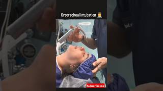 Orotracheal Intubation techniques health hospital intubation ivcannulation rn medical [upl. by Spark]