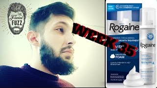 Minoxidil Beard  8 MONTHS  Week 35  Minoxidil 5 for Beard Growth  Facialfuzzfridays [upl. by Lorak637]