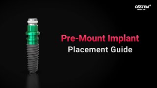 PreMount Implant Placement Guide [upl. by Harshman]