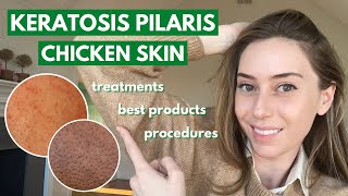 Keratosis Pilaris How to treat dry bumpy skin aka chicken skin  Dr Shereene Idriss [upl. by Faunia380]