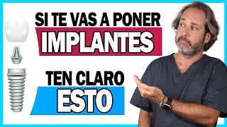 📌𝗜𝗡𝗙𝗢𝗥𝗠𝗔𝗖𝗜𝗢𝗡 𝗖𝗟𝗔𝗩𝗘 sobre la 𝗖𝗢𝗟𝗢𝗖𝗔𝗖𝗜𝗢𝗡 𝗜𝗠𝗣𝗟𝗔𝗡𝗧𝗘𝗦 dentales paso a paso explicada TE INTERESA 👌 [upl. by Pardoes]