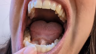 Do you want to see my teeth tour 😁👅 Tongue and Teeth Close Up MOLARS 🤤 [upl. by Gnart]