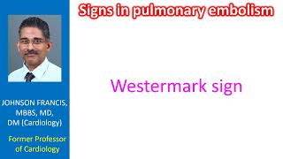 Signs in pulmonary embolism [upl. by Mazman467]