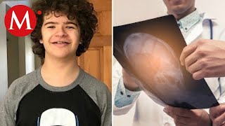 ¿Qué es displasia Cleidocraneal la enfermedad que padece Gaten Matarazzo [upl. by Alanson]