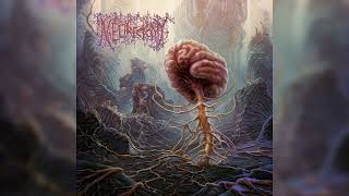 Neurectomy  quotOverwroughtquot Full Album [upl. by Brainard315]