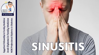 Sinusitis [upl. by Ijan353]