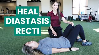 Exercises to Fix Your Diastasis Recti  Physical Therapy [upl. by Robaina]