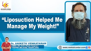 Patient Review Of The Liposuction Procedure  Dr Aniketh Venkataram  The Venkat Center Bengaluru [upl. by Verge]