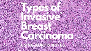 Types of Invasive Breast Carcinoma Kurt’s Notes pathagonia [upl. by Nawat921]