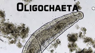 Howies Lab  Worm Oligochaeta [upl. by Yorker]