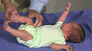 physical exam Newborn Normal TonePopliteal Angle [upl. by Thetos]