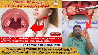 அறுவை சிகிச்சையின்றி டான்சில் Tonsillitis குணப்படுத்த முடியுமாடான்சில் நீக்கினால் என்ன நடக்கும் [upl. by Francisca]