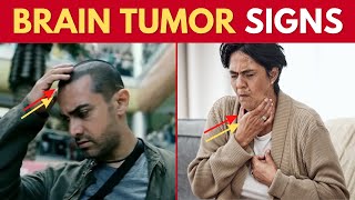 8 Warning Signs You Have A Brain Tumor  Early Detect It [upl. by Raimund]