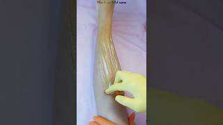 Wax hair removal with honey on the leg elenazaitsevadepilprof [upl. by Ellekram]