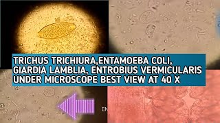 Trichus trichuriaEntamoeba coliGiardia lambliEntrobius vermicularis best microscopic view at 40X [upl. by Anilys]