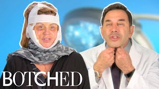 Dr Nassif Fixes Lisa’s Facelift Gone Wrong FULL TRANSFORMATION  Botched  E [upl. by Gertruda]