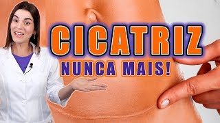 Adeus CICATRIZ no Rosto e no Corpo  Saiba como TRATAR e PREVENIR CICATRIZES [upl. by Eloisa132]