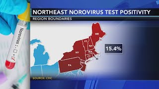 Contagious stomach bug circulating in the Northeast  Know the symptoms [upl. by Rehnberg]