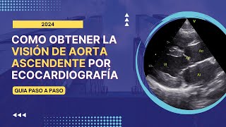 🎯Como obtener la 🎨VISION DE AORTA ASCENDENTE por ECOCARDIOGRAFÍA Guía paso a paso [upl. by Nodroj]