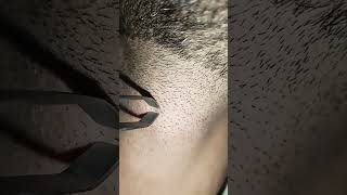 hair removal short removery hairstyle hairreplacment [upl. by Haem]