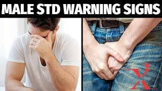 Common STDs Warning Signs amp Symptoms of Viral STDs [upl. by Tufts]