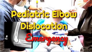 Pediatric Elbow Dislocation How to Recognize and Treat [upl. by Malva]