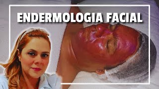 REVITALIZAÇÃO FACIAL COM ENDERMOLOGIA  Protocolo Prático de Estética Profissional [upl. by Zenas876]