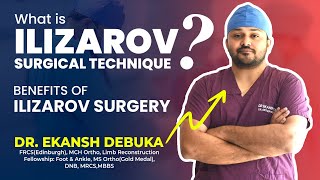 What is Ilizarov Surgery  Technique and Benefits  By Dr Ekansh Debuka  Orthopedics  Ranchi [upl. by Orva]