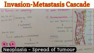 InvasionMetastasis Cascade  Spread of Tumour  Neoplasia [upl. by Hibben]