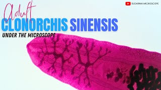 Adult Clonorchis sinensis under the microscope [upl. by Yarrum]