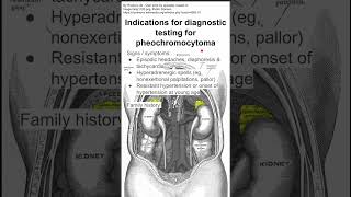 Indications for diagnostic testing for pheochromocytoma [upl. by Canning]