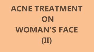 Acne Treatment on Womans Face II  Left side [upl. by Eicrad]