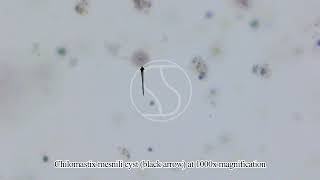 Chilomastix mesnili Cyst under the microscope [upl. by Gerbold]