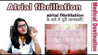 Atrial fibrillation  causes  symptoms  prevention and treatment in hindi  medical Destination [upl. by Reena141]