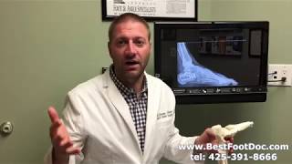 Calcaneal Fractures A Brief Overview [upl. by Macilroy]