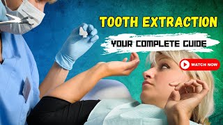 Tooth Extraction Demystified  Your Complete Guide [upl. by Plerre686]