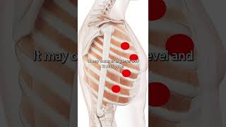 The Intercostal Muscle Trigger Points [upl. by Rexer]