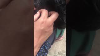 ASMR killing lot of lice From the school boy head👍 [upl. by Kipton]