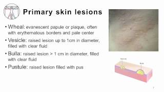 4 Primary and Secondary skin lesions [upl. by Omlesna]