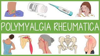 Polymyalgia Rheumatica [upl. by Arnie273]