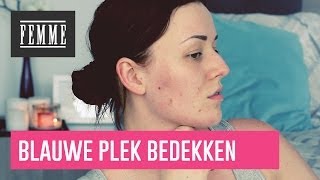 Blauwe plekken bedekken  FEMME [upl. by Brunelle]